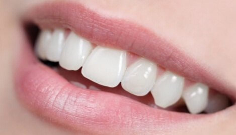 zuby bez zubniho plaku